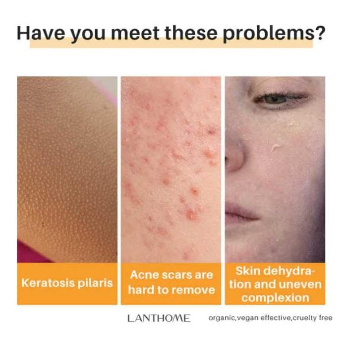 KOJIC ACID SOUP